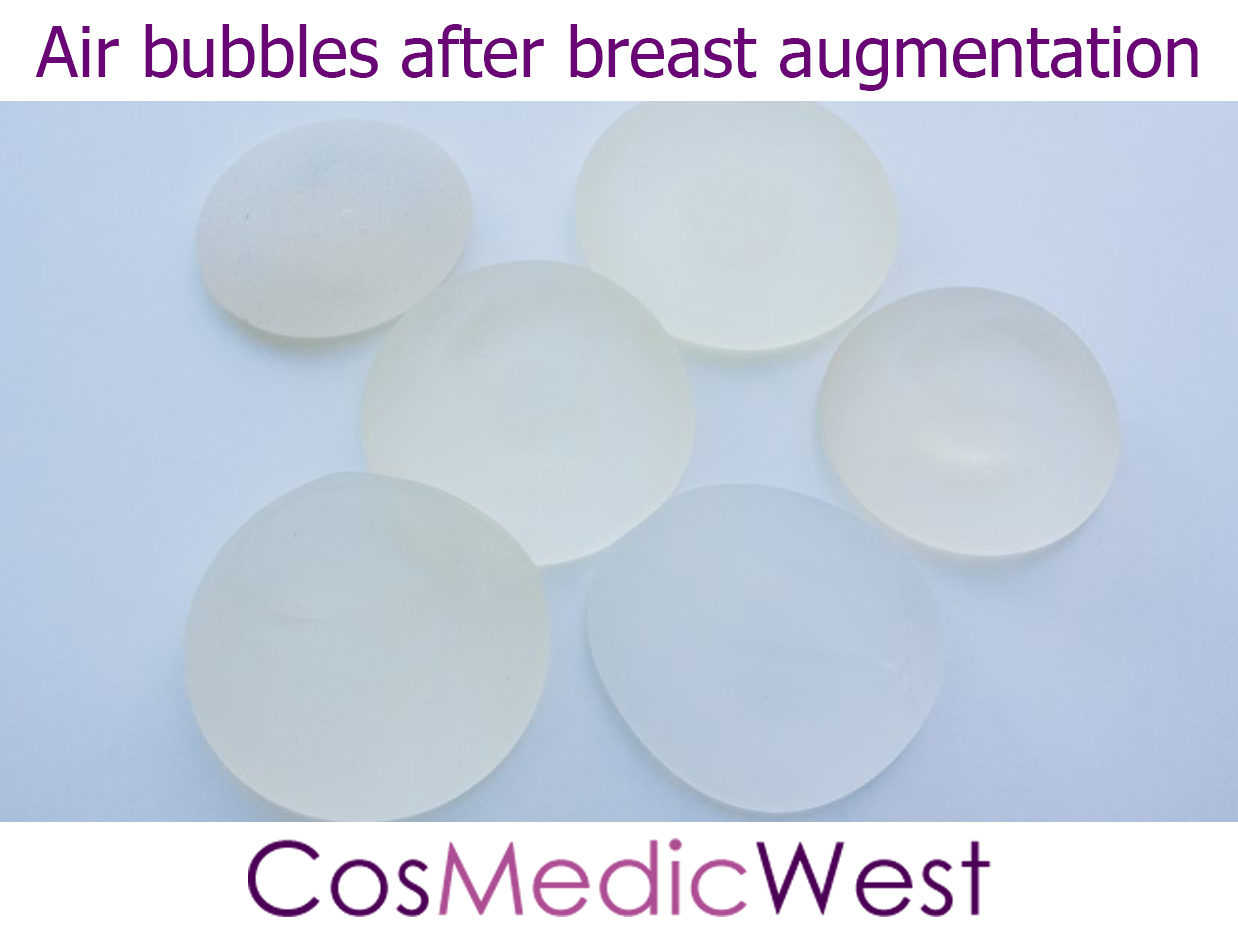 Air bubbles after breast augmentation