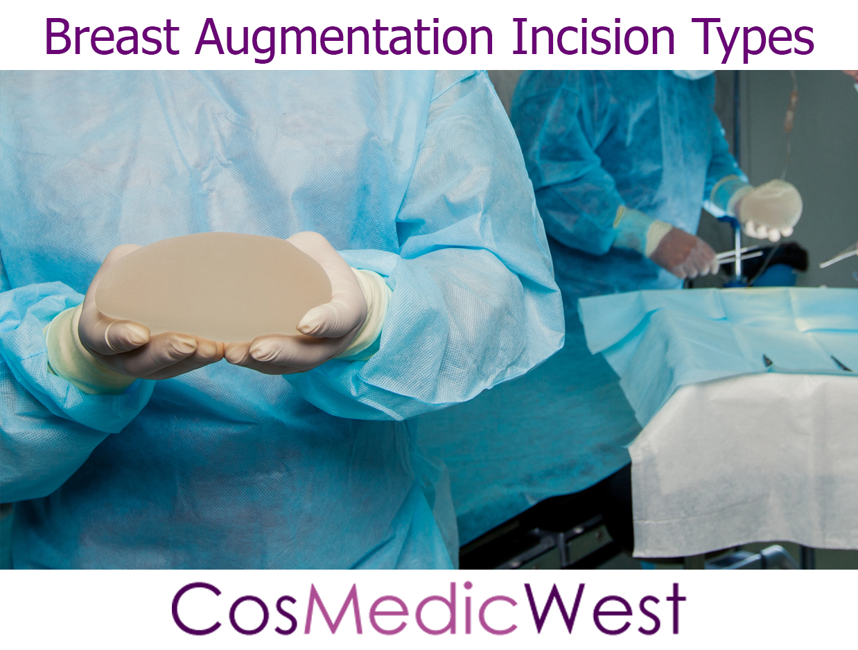 Breast Augmentation Incision Types - Cosmetic Surgery