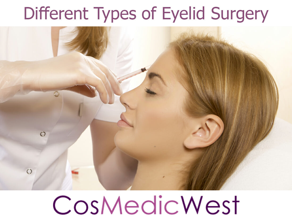 Different Types of Eyelid Surgery